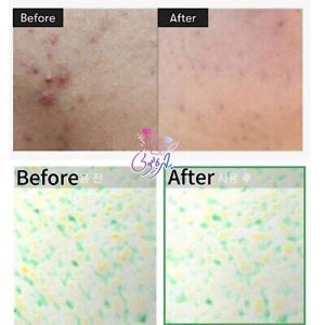 سرم میکرونیدلینگ ریدل شات VT Reedle Shot 1 سرم میکرونیدلینگ ریدل شات VT Reedle Shot