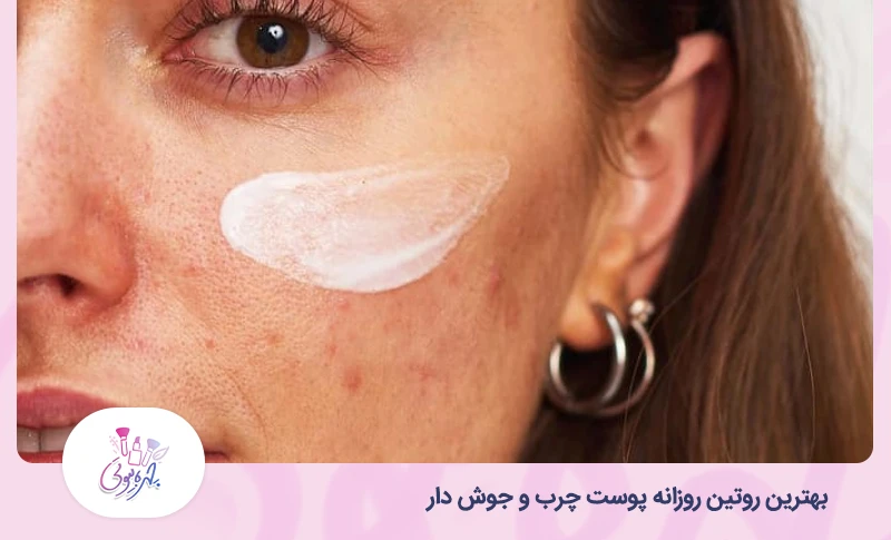 بهترین روتین روزانه پوست چرب و جوش دار 7 S29 1