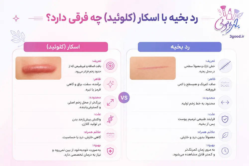 لیست بهترین کرم ترمیم کننده جای بخیه خارجی و ایرانی 3 رد بخیه با اسکار (کلوئید) چه فرقی دارد؟